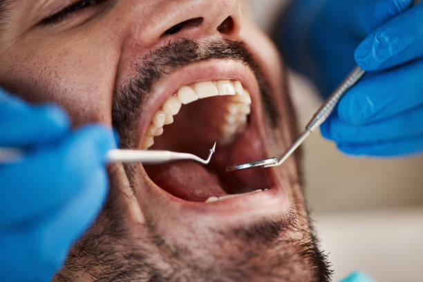 Best Emergency Treatment for Oral Infections in Cleora, OK